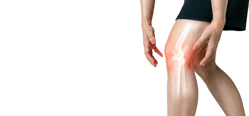 Artroscopia de Rodilla en Monterrey