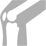 Operación de rodilla, Ortopedista en Monterey, Dr Eduardo Alvarez