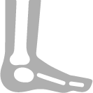 Cirugía de Tobillo, Ortopedista en Monterey, Dr Eduardo Alvarez